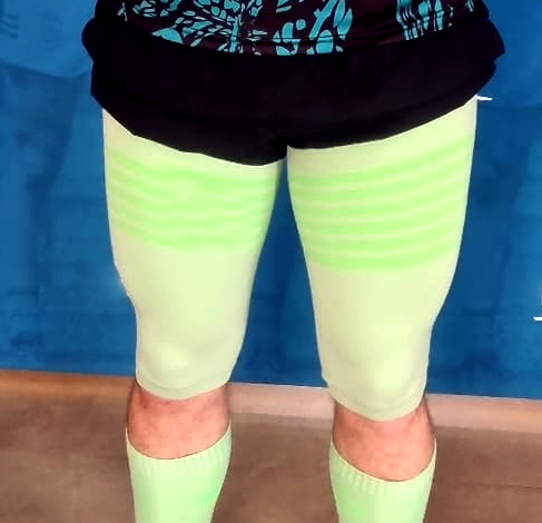 Thigh Sleeves